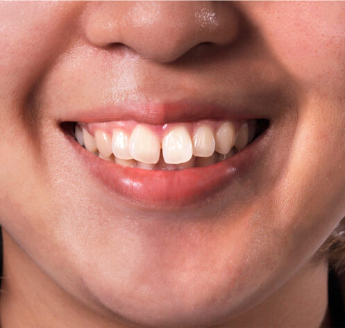 ORTHODONTICS tREATMENT ORTHODONTICS tREATMENT