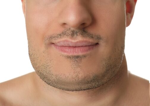 Double,Chin,Problem.,Collage,With,Photos,Of,Man,Before,And Double,Chin,Problem.,Collage,With,Photos,Of,Man,Before,And