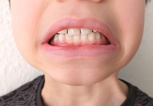 Child,,Kid,Shows,Tooth,That,Sways,And,Hurts,,The,Concept Child,,Kid,Shows,Tooth,That,Sways,And,Hurts,,The,Concept
