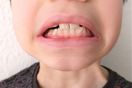Child,,Kid,Shows,Tooth,That,Sways,And,Hurts,,The,Concept Child,,Kid,Shows,Tooth,That,Sways,And,Hurts,,The,Concept